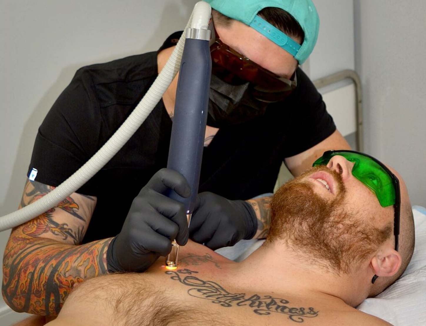 ND Pro Tattoo Laser Removal Machine